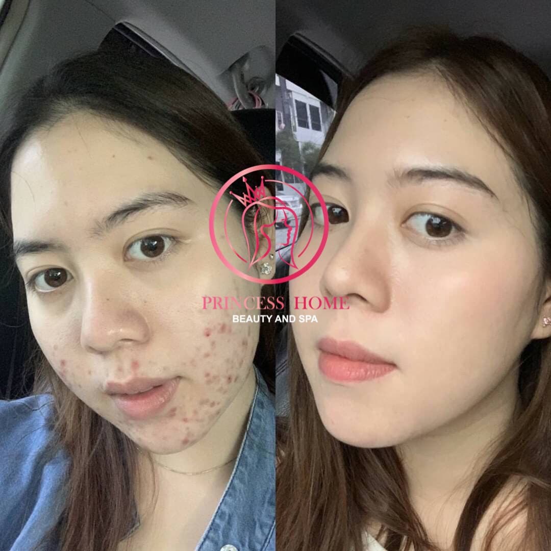 Princess Home (ปริ้นเซส โฮม) สาขาพายัพ (公主屋美容按摩) massage shop photo 8