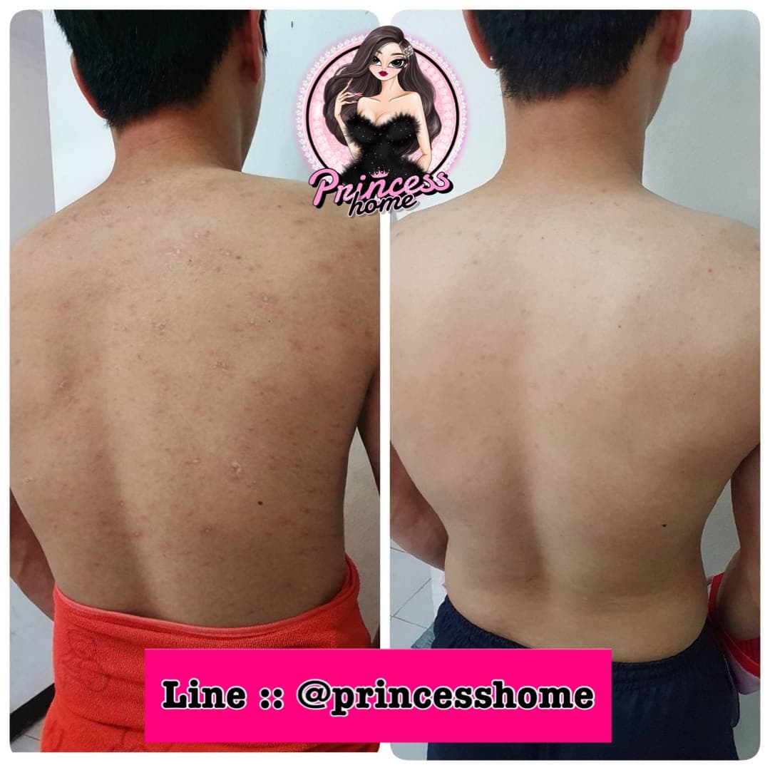 Princess Home (ปริ้นเซส โฮม) สาขาพายัพ (公主屋美容按摩) massage shop photo 9